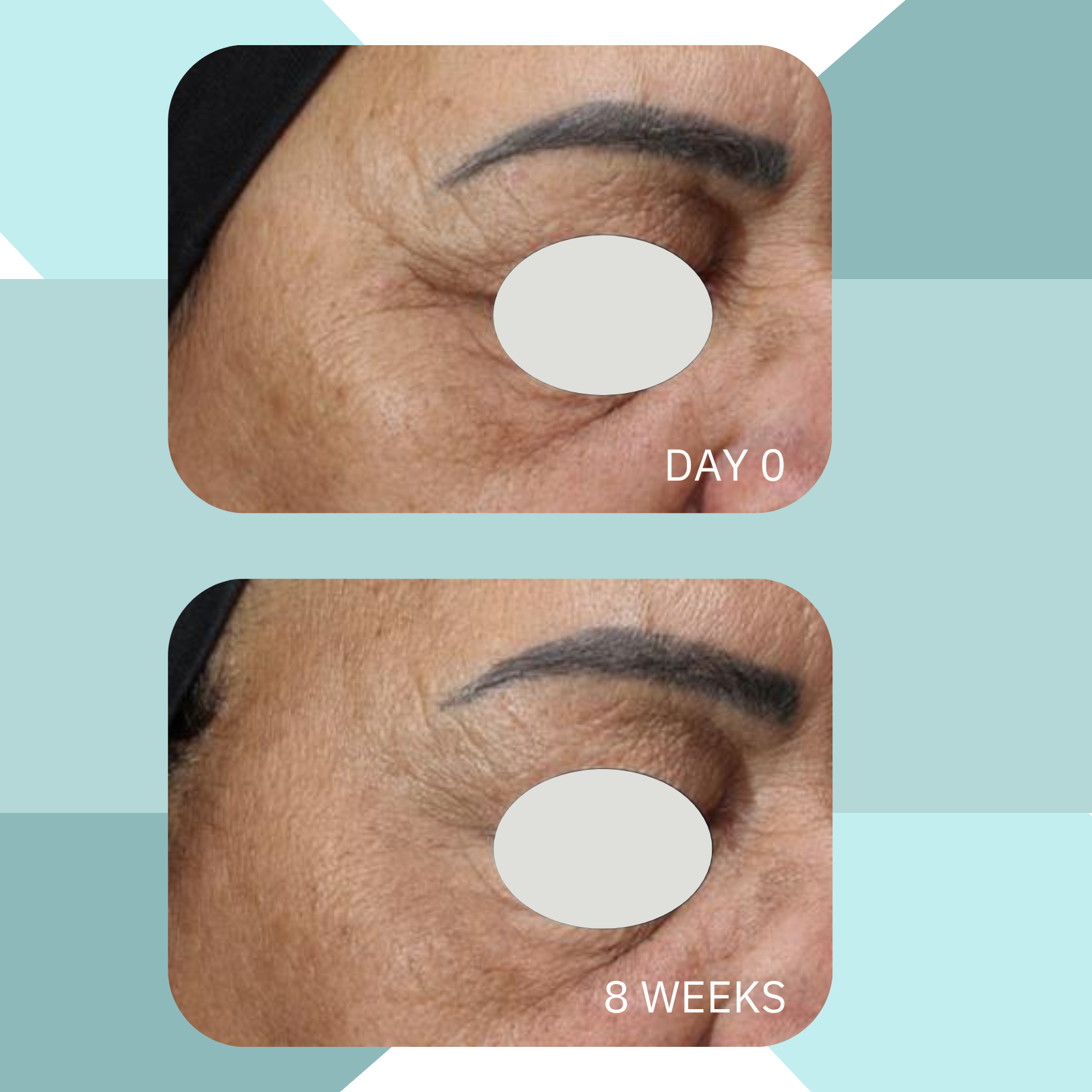 The Gorgeous Skin Trifecta BEST VALUE!